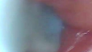 First Time: an Endoscope Reveals the G-spot up Close - Without Mounting!