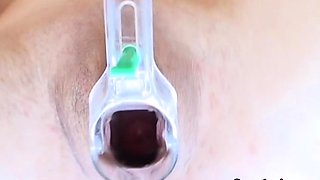 Speculum teen enjoys objects pussy insertion and gaping