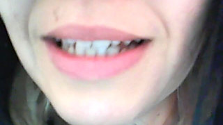 You've Been Surprised Again Eh?!