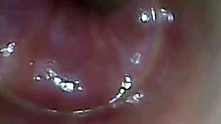 Endoscope POV: Test Tube Cock Urethral Insertion