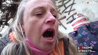 10k Usd Vaginal Prolapse Xxx