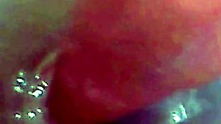 Endoscope POV: Test Tube Cock Urethral Insertion
