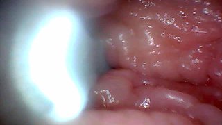 First Time: an Endoscope Reveals the G-spot up Close - Without Mounting!