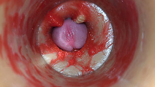 Camera Inside Deep Pussy Captures Very Huge Ejaculation of Sperm ASMR