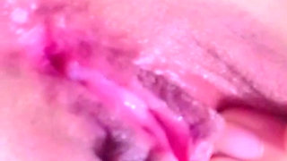 Jdid tbiba f cabinet tbanyat ma9dratch tassbor