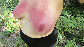 Red Breasts in the Forest