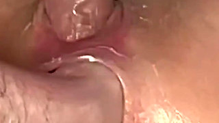 Closeup Creampie Overflow My Prolapsed Asshole