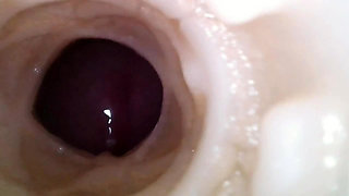 Sperm Giant in Hamburg