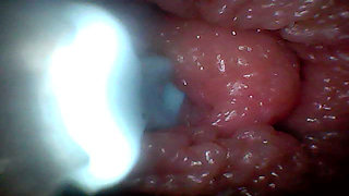 Extreme Proximity Turns Watcher Into Active, Hungry Participant