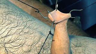 An Artful Study in Needles and Steel
