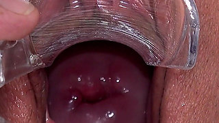 Big Clit Pussy Examined with Speculum
