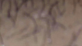 Step son couldn't take care of his erection with broken arm so he asked step mom a handjob