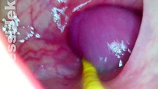 Jessi Jek - Endoscope In Girl Shows Anal Fuck - Ass Mastrubate And Creampie Wth Fan