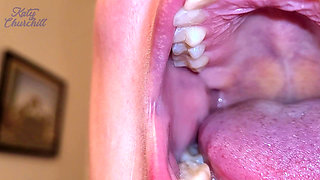 Mouth Tour with a Bottom Retainer